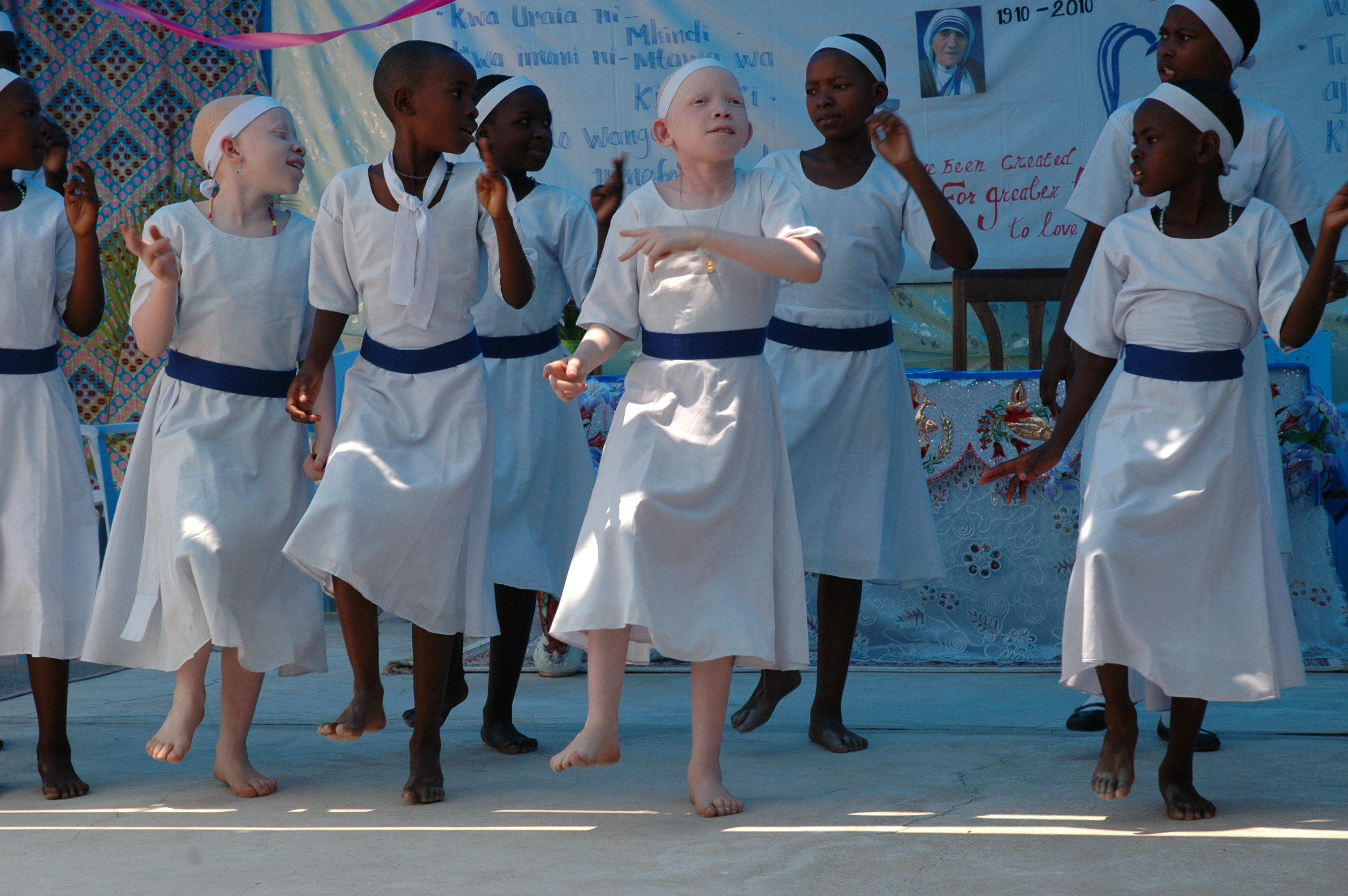 Dancing Albino Girls