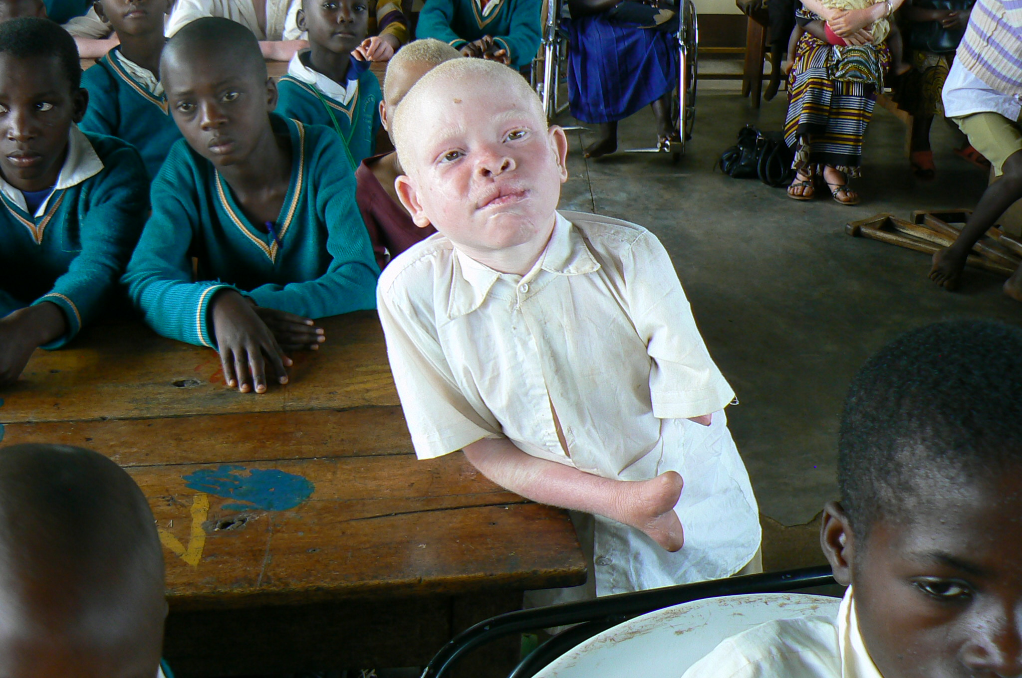 Dancing Albino Girls